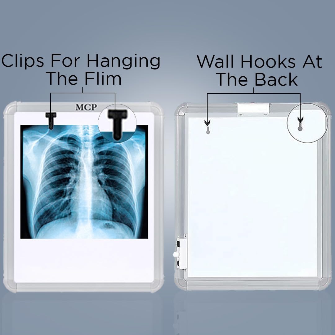 MCP X-Ray View Box digital for clinic LED Illuminator Radiology (Automatic Single Film illumination) with variable brightness cont (mcp xray view box) 5